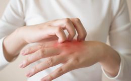 Besin alerjileri neden artıyor?