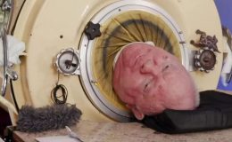 70 yıldır demir bir kafeste yaşıyordu… Paul Alexander hayatını kaybetti